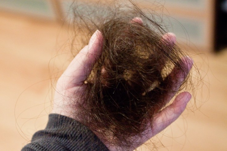 Causes de la chute des cheveux chez les femmes après 40 ans