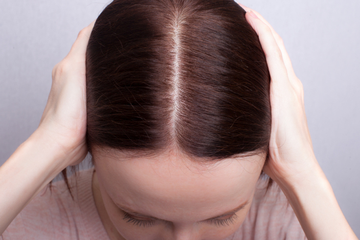 Causes de la chute des cheveux chez les femmes après 40 ans