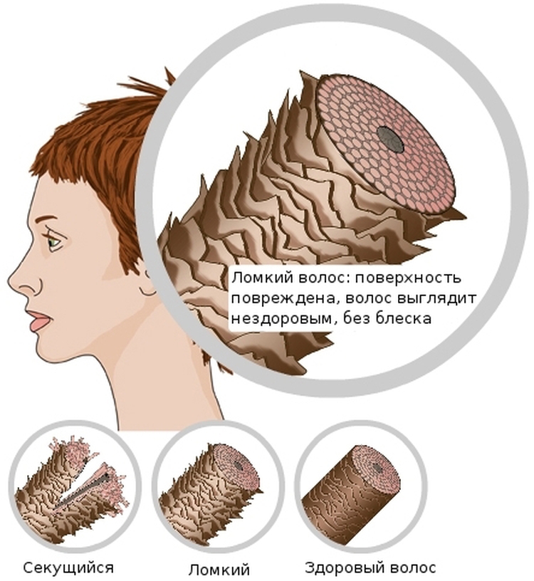 Permanente de cheveux