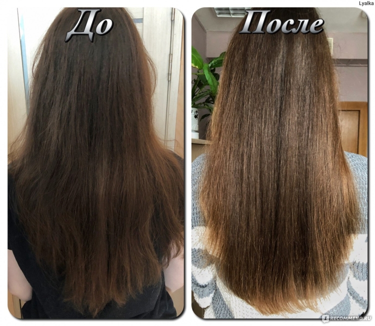Huile de jasmin pour les cheveux avantages et applications