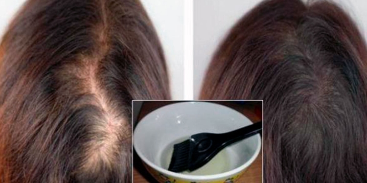Huile de ricin pour cheveux à la maison