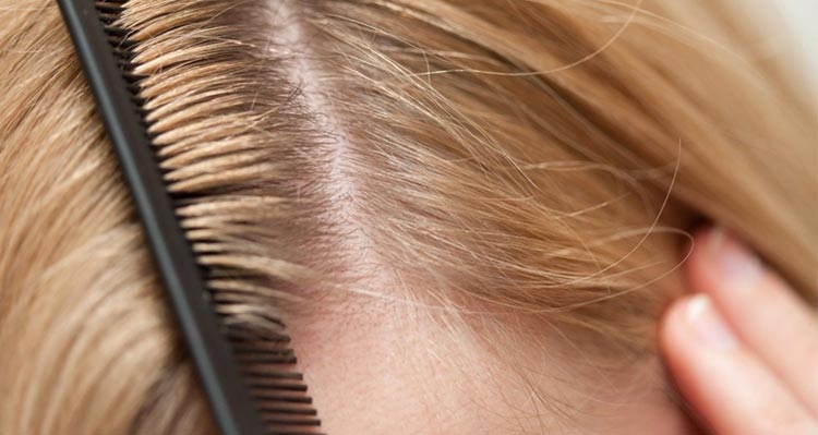 Masques antipelliculaires faits maison pour les cheveux