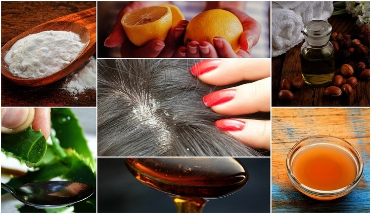 Masques antipelliculaires faits maison pour les cheveux