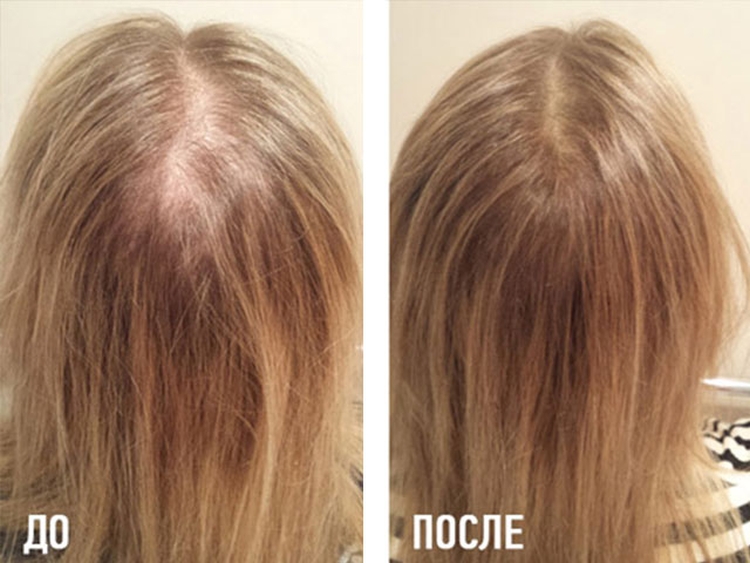 Comment faire pousser les cheveux après une coupe courte