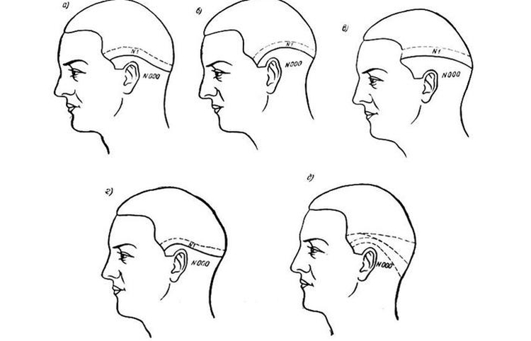 Coiffure sportive homme