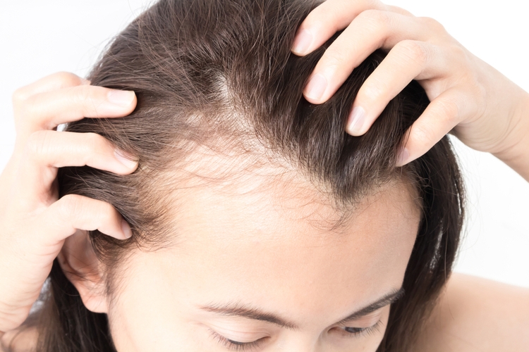 Remèdes populaires pour la perte de cheveux chez les femmes à la maison