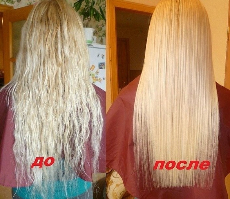 La bixiplastie pour les cheveux c'est quoi