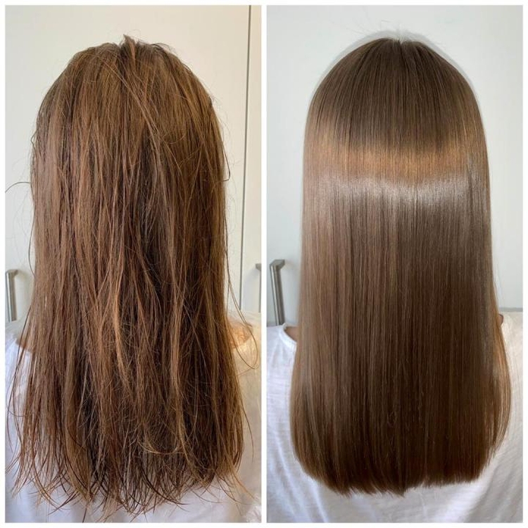 La bixiplastie pour les cheveux c'est quoi