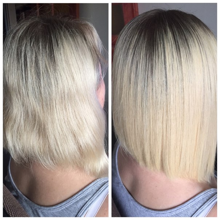 La bixiplastie pour les cheveux c'est quoi