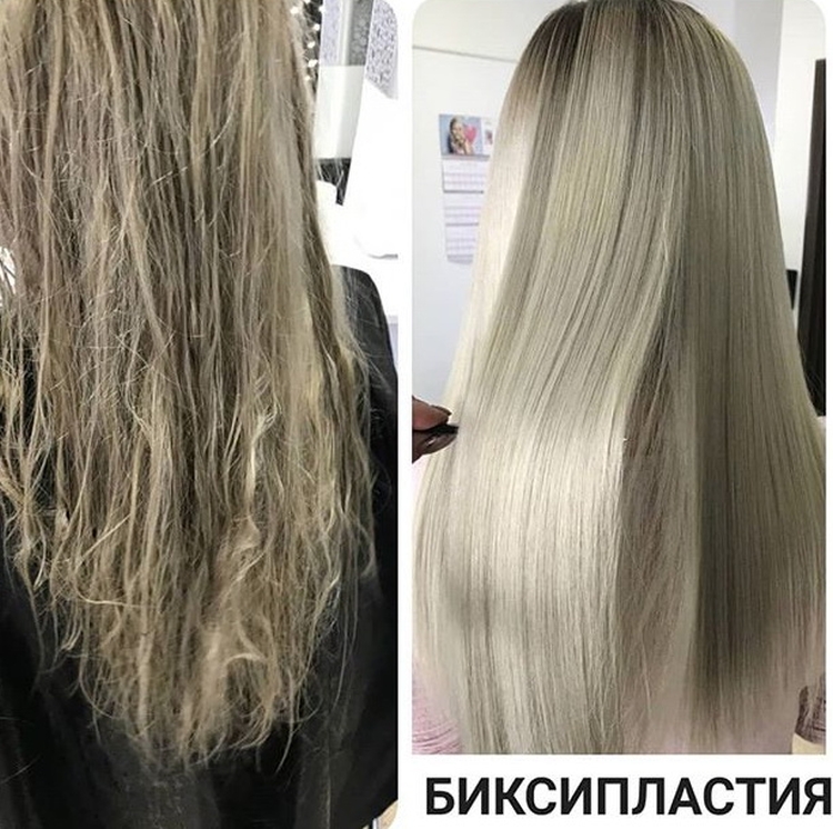 La bixiplastie pour les cheveux c'est quoi