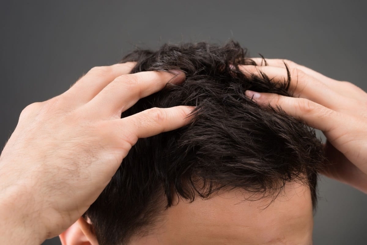 La restauration des cheveux de Jack