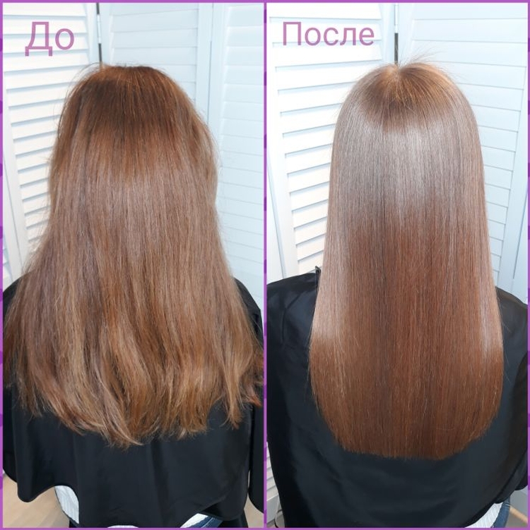 La bixiplastie pour les cheveux c'est quoi