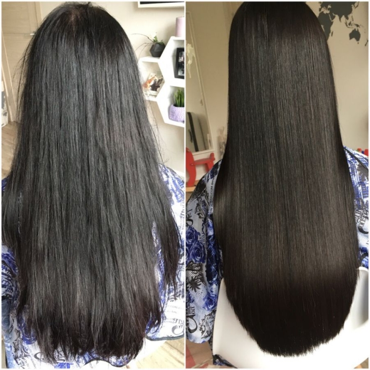 La bixiplastie pour les cheveux c'est quoi