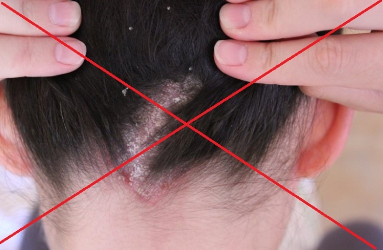 Protection des cheveux qu'est-ce que c'est