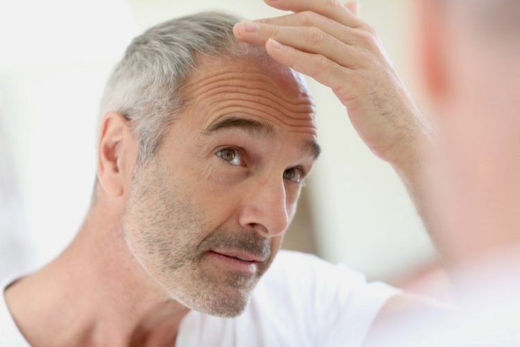 Remède cheveux gris pour hommes