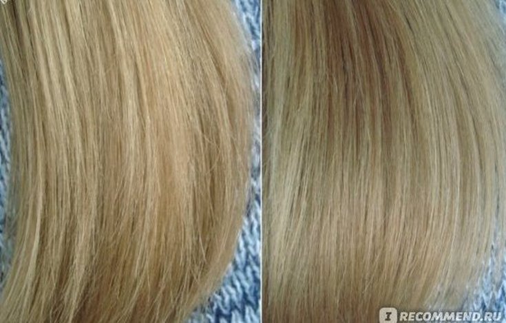 Évaluation des produits Botox