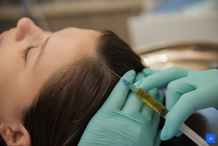 Thérapie à l'ozone pour le cuir chevelu
