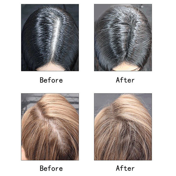 Top 5 des meilleurs épaississants pour cheveux
