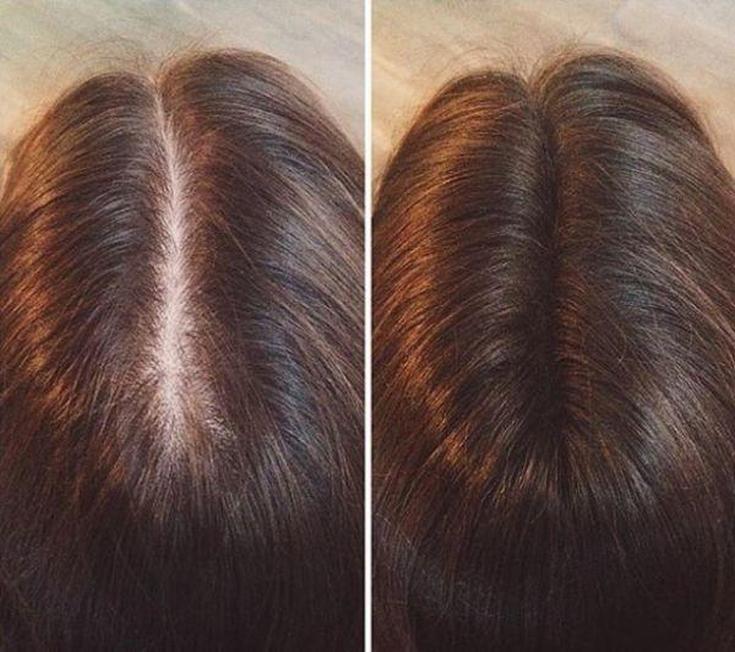 Top 5 des meilleurs épaississants pour cheveux