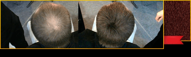 Top 5 des meilleurs épaississants pour cheveux