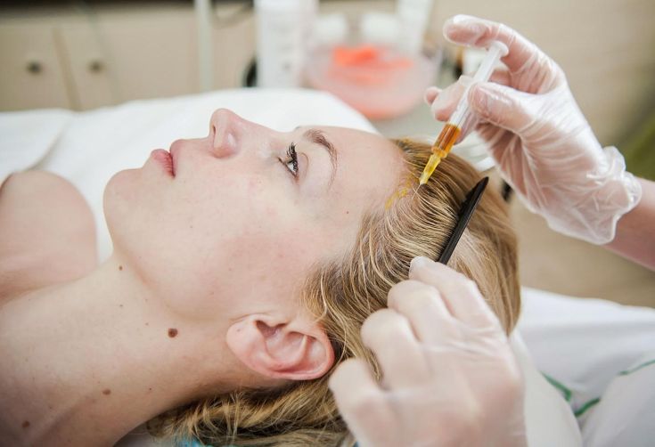 Plasmolifting pour la chute des cheveux