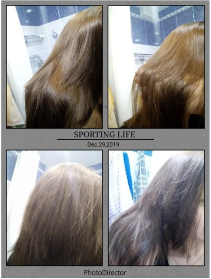 Top 5 des meilleurs remplisseurs de cheveux