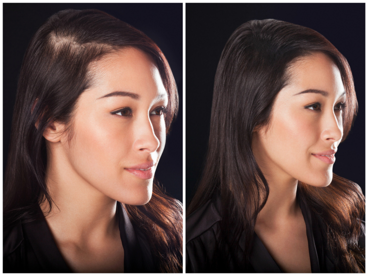 Top 5 des meilleurs épaississants pour cheveux