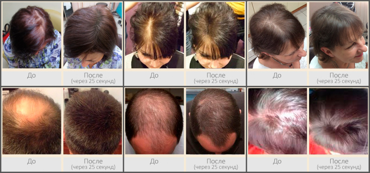 Top 5 des meilleurs épaississants pour cheveux