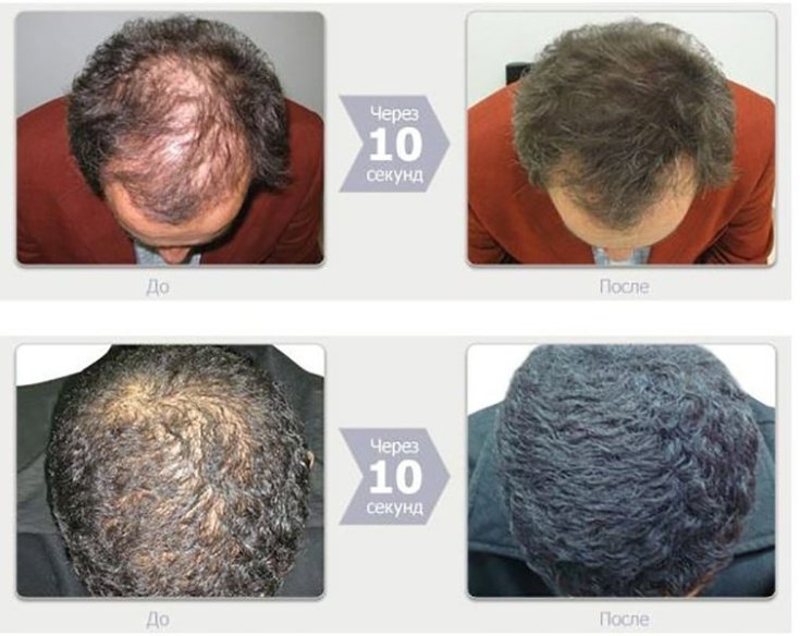 Top 5 des meilleurs épaississants pour cheveux