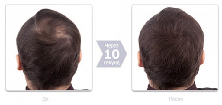 Top 5 des meilleurs épaississants pour cheveux