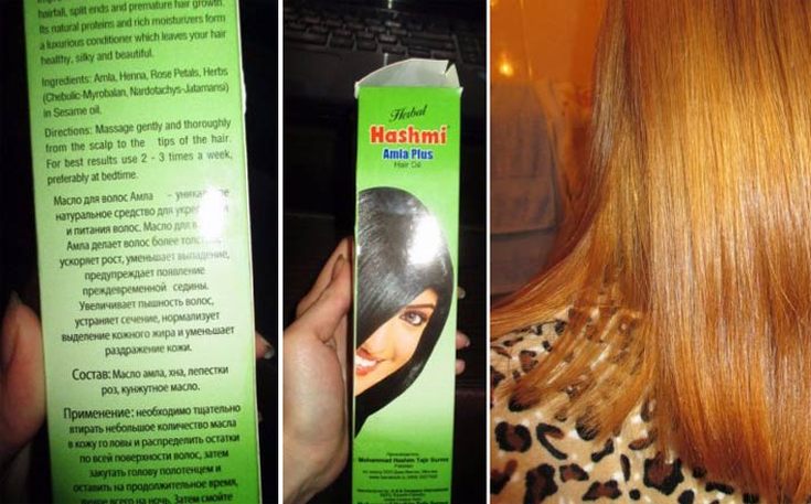 huile d'amla pour les cheveux