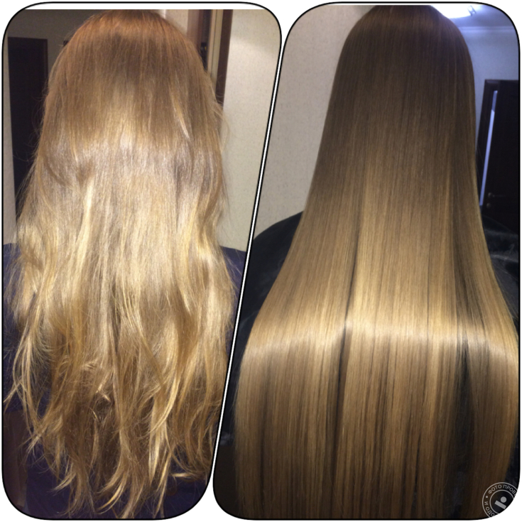 Reconstruction des cheveux