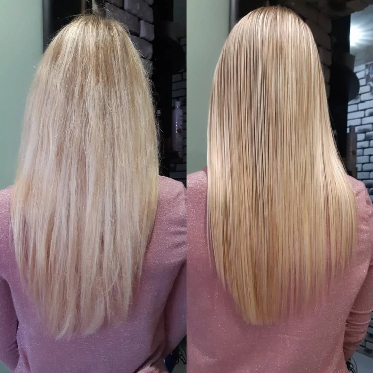 Reconstruction des cheveux